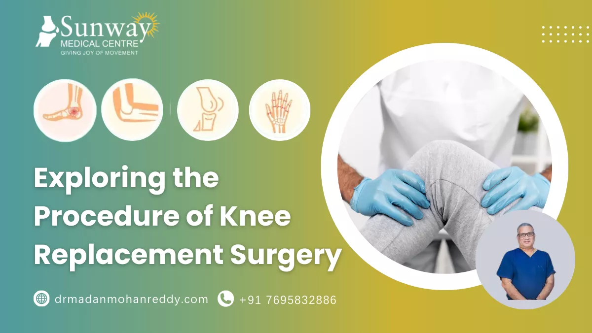 Exploring the Procedure of Knee Replacement Surgery