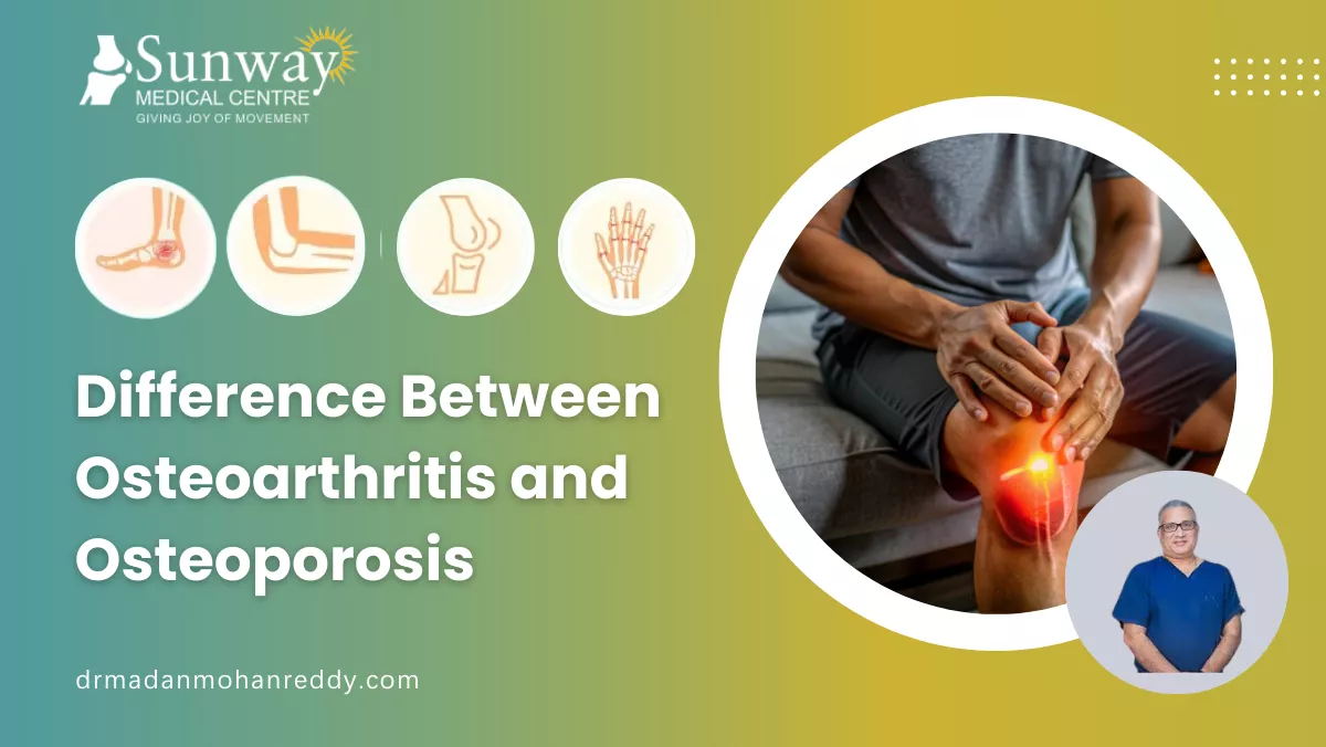 Difference Between Osteoarthritis and Osteoporosis