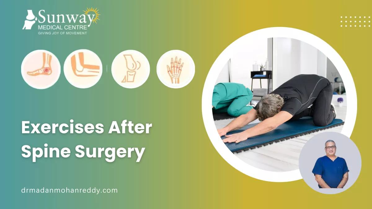 Exercises After Spine Surgery