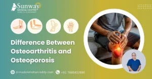 Difference Between Osteoarthritis and Osteoporosis
