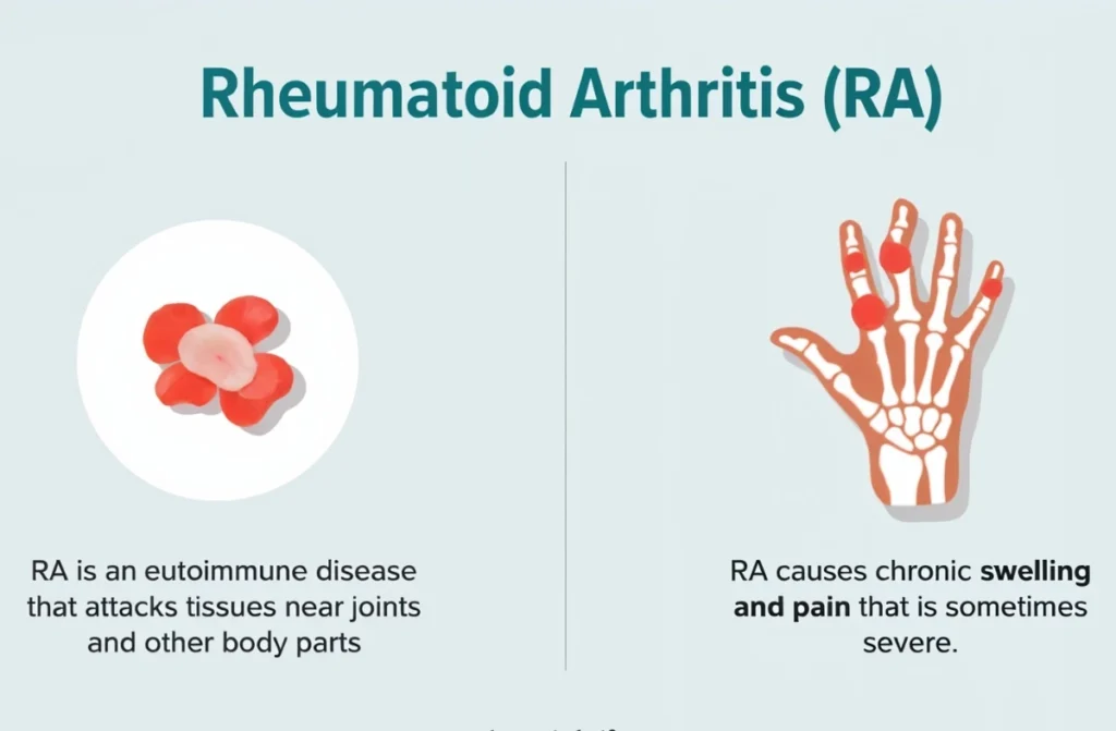 Best Treatment for Rheumatoid Arthritis
