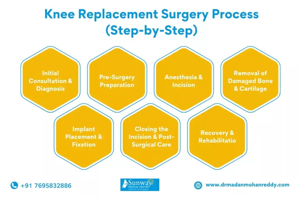 Types of Knee Replacement Surgery