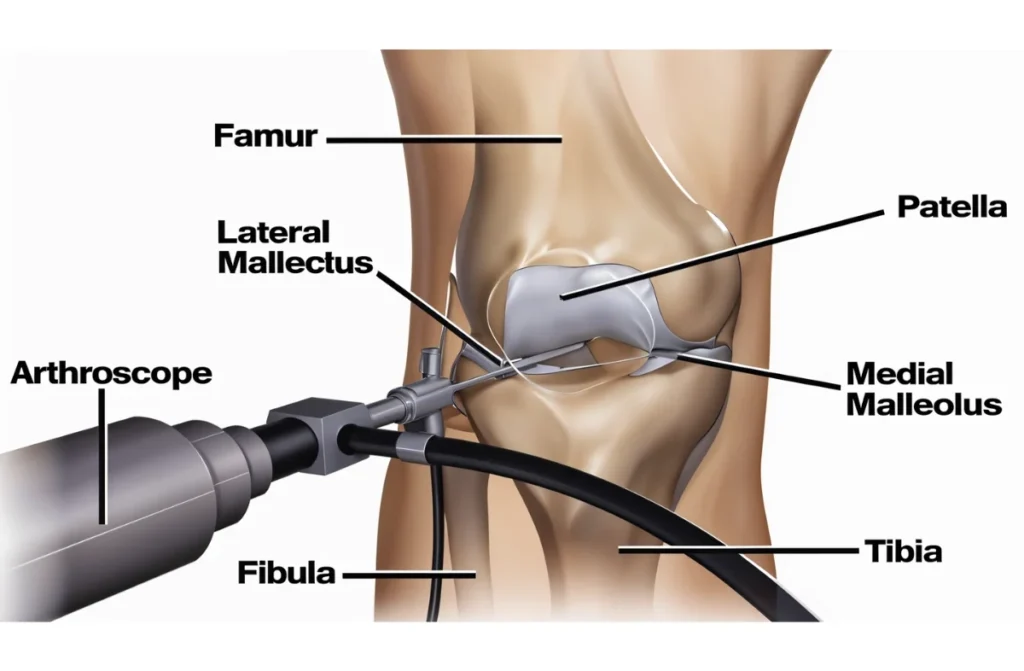 Minimally Invasive Orthopedic Surgery