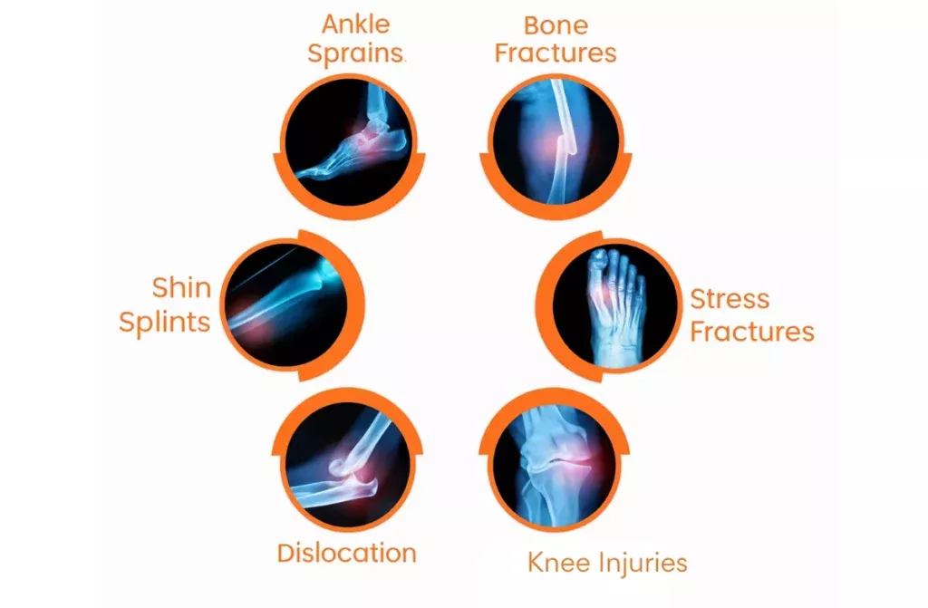 Most Common Sports Injuries