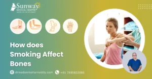 How Does Smoking Affect Bones