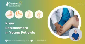 Knee Replacement in Young Patients