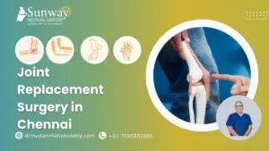 Joint Replacement Surgery in Chennai