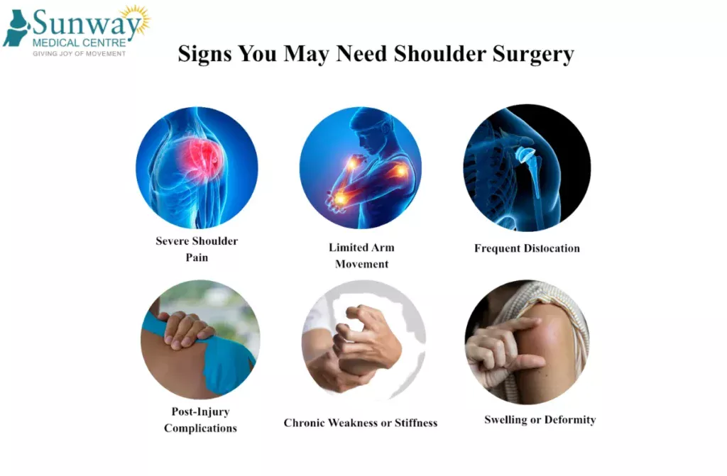 Best Shoulder Surgeon in India