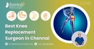 Best Knee Replacement Surgeon in Chennai