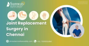Joint Replacement Surgery in Chennai