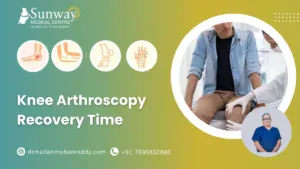 Knee Arthroscopy Recovery Time