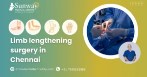 Limb lengthening surgery in Chennai