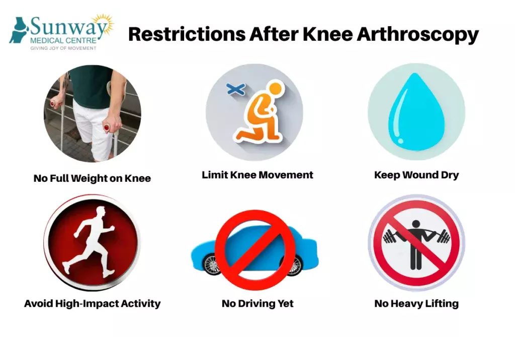  Knee Arthroscopy Recovery Time 